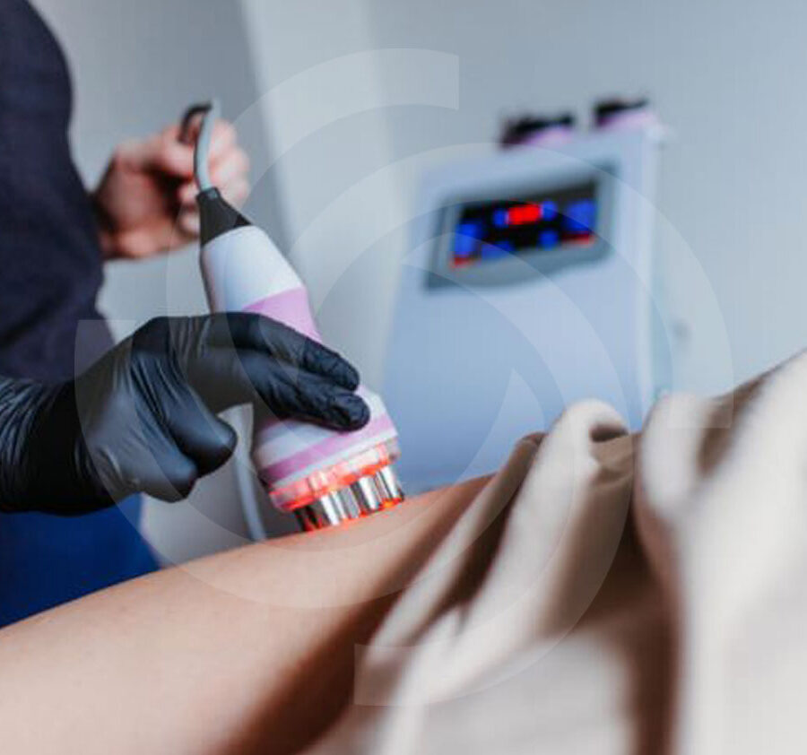 Cavitation and Radiofrequency