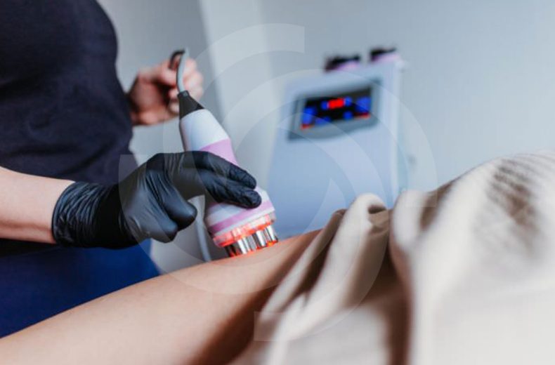 Service - Ultrasound Cavitation - RF Contouring